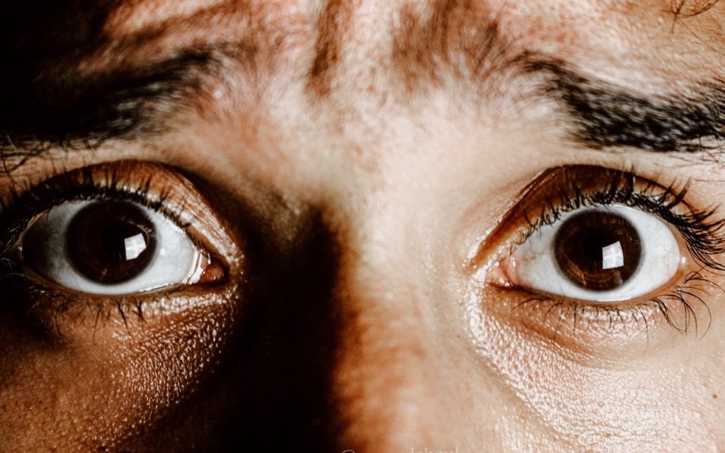 A close-up of a persons face showing wide open eyes and raised eyebrows, expressing fear or shock. The image highlights the skin texture and intense emotion.