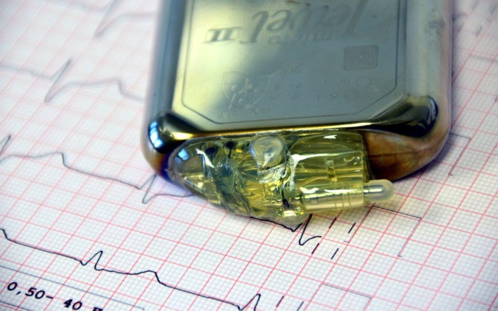 A cardiac pacemaker device placed on top of an electrocardiogram (ECG) printout showing heart activity. The pacemakers leads and metal casing are visible.